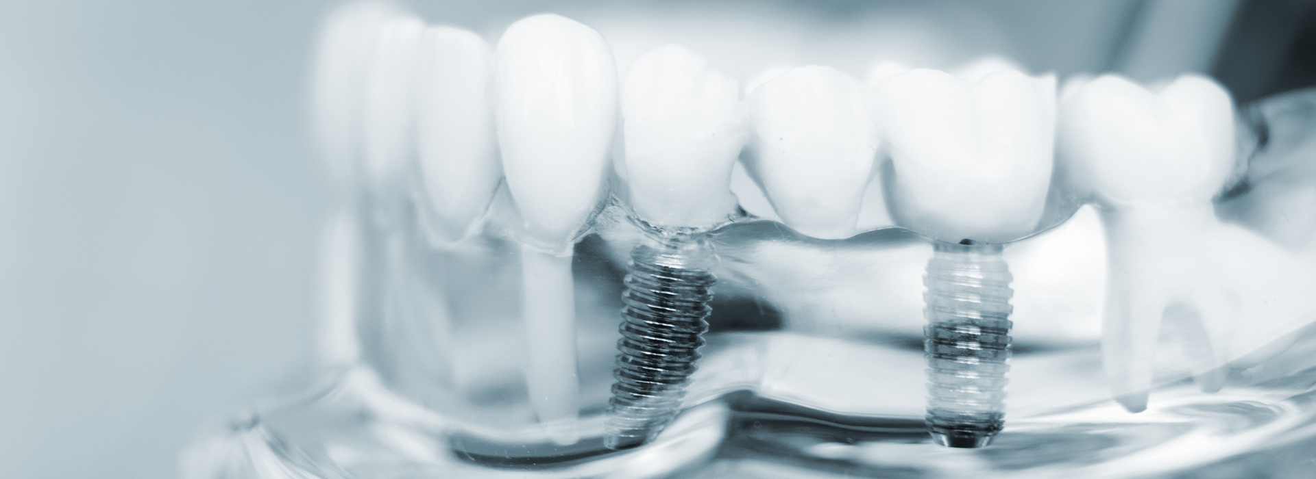 Wohl and Trail Periodontics and Dental Implants | Causes of Periodontal Disease, Sinus Augmentation and Bruxism Treatment
